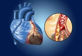 CHECK-UP DE COLESTEROL